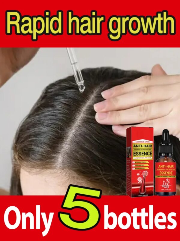 Fast Hair Growth Essence Oil Effective Baldness Repair Hereditary Hair Loss Treatment Seborrheic Alopecia Loss For Men Women